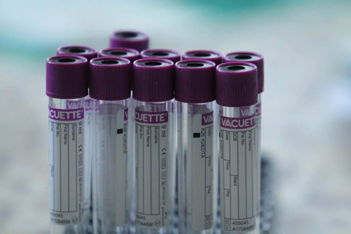 САЩ подписаха договор с AstraZeneca за доставка на лекарство срещу COVID-19